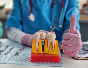 Qatar Prometric Exam for Dental Assistants